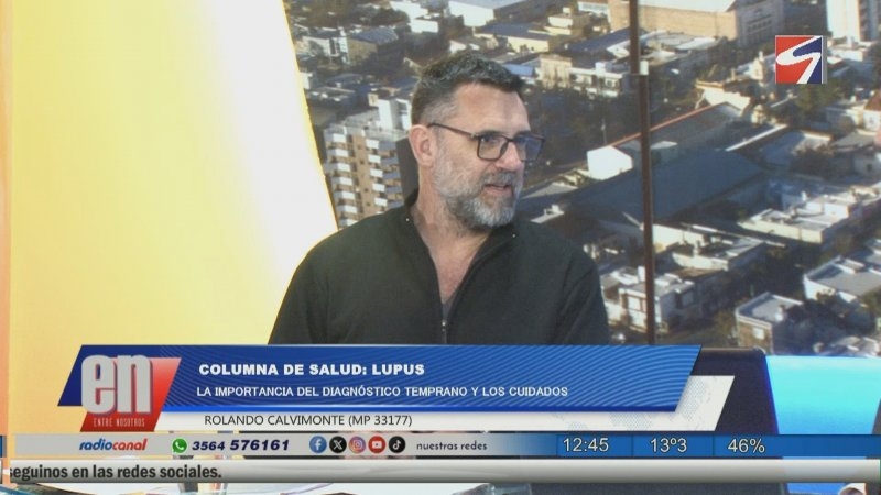 Columna de Salud: Lupus